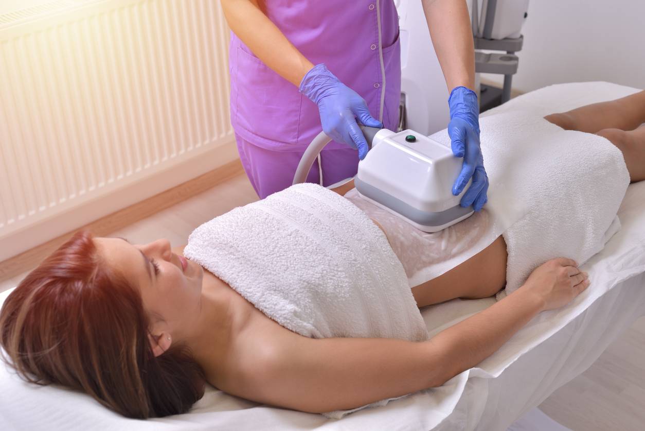 cryolipolyse pour maigrir